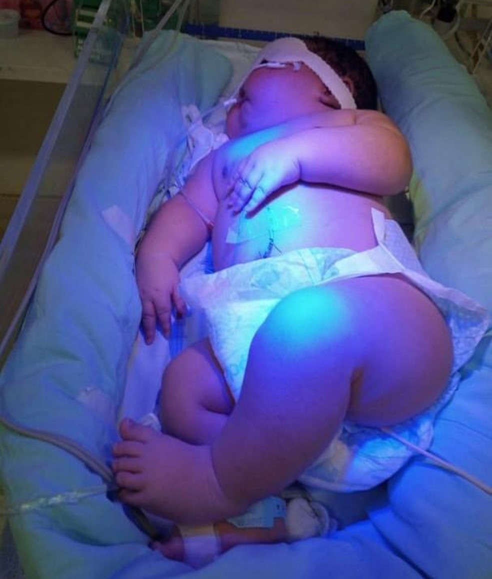 Criança nasce com quase 8kg em Teresina